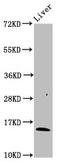 Hemoglobin Subunit Beta antibody, CSB-PA010150LA01HU, Cusabio, Western Blot image 