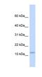 Plasminogen Receptor With A C-Terminal Lysine antibody, NBP1-59462, Novus Biologicals, Western Blot image 