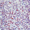 Cyclin Dependent Kinase Inhibitor 1C antibody, LS-C88694, Lifespan Biosciences, Immunohistochemistry frozen image 