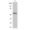 Serum/Glucocorticoid Regulated Kinase 1 antibody, LS-C386051, Lifespan Biosciences, Western Blot image 