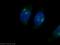 Proteasome Subunit Beta 3 antibody, 15983-1-AP, Proteintech Group, Immunofluorescence image 