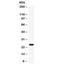 WAP Four-Disulfide Core Domain 2 antibody, R32389, NSJ Bioreagents, Western Blot image 