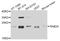 RAB24, Member RAS Oncogene Family antibody, STJ110692, St John