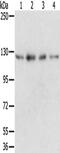 RNA Binding Motif Protein 5 antibody, CSB-PA954329, Cusabio, Western Blot image 