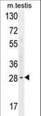 YdjC Chitooligosaccharide Deacetylase Homolog antibody, LS-C160679, Lifespan Biosciences, Western Blot image 