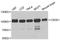 Cold Shock Domain Containing E1 antibody, STJ27737, St John