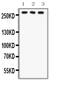 FAS antibody, PB9865, Boster Biological Technology, Western Blot image 