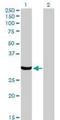 Protein Activator Of Interferon Induced Protein Kinase EIF2AK2 antibody, orb94676, Biorbyt, Western Blot image 
