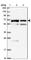 Transmembrane Protein 200C antibody, HPA047253, Atlas Antibodies, Western Blot image 