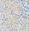 Stp antibody, FNab08376, FineTest, Immunohistochemistry paraffin image 