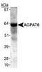 Glycerol-3-phosphate acyltransferase 4 antibody, TA309568, Origene, Western Blot image 