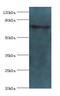 Enoyl-CoA Hydratase And 3-Hydroxyacyl CoA Dehydrogenase antibody, LS-C371319, Lifespan Biosciences, Western Blot image 