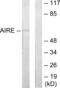 Autoimmune Regulator antibody, abx013298, Abbexa, Western Blot image 