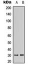 Dehydrogenase/Reductase 11 antibody, orb315771, Biorbyt, Western Blot image 