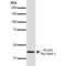 Sodium channel subunit beta-3 antibody, LS-C773664, Lifespan Biosciences, Western Blot image 