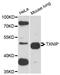 Thioredoxin Interacting Protein antibody, STJ113636, St John