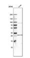 Solute Carrier Family 27 Member 3 antibody, NBP1-89265, Novus Biologicals, Western Blot image 