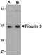 EGF Containing Fibulin Extracellular Matrix Protein 1 antibody, MBS150666, MyBioSource, Western Blot image 