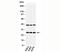 C-Type Lectin Domain Family 4 Member E antibody, 33-011, ProSci, Western Blot image 
