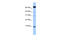 Dynein Light Chain LC8-Type 2 antibody, 30-826, ProSci, Enzyme Linked Immunosorbent Assay image 