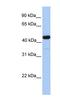 Galactose-3-O-Sulfotransferase 3 antibody, NBP1-62277, Novus Biologicals, Western Blot image 