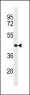 Zinc finger protein 73 antibody, PA5-49151, Invitrogen Antibodies, Western Blot image 