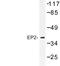 Prostaglandin E Receptor 2 antibody, LS-C177087, Lifespan Biosciences, Western Blot image 