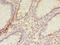 Transmembrane Protein 165 antibody, LS-C376826, Lifespan Biosciences, Immunohistochemistry paraffin image 