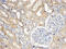 Sorting Nexin 8 antibody, AP33411PU-N, Origene, Immunohistochemistry paraffin image 