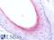 Keratin 84 antibody, LS-B13611, Lifespan Biosciences, Immunohistochemistry paraffin image 