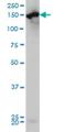 Carbamoyl-Phosphate Synthase 1 antibody, H00001373-M01, Novus Biologicals, Western Blot image 