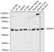 Dolichyl-Diphosphooligosaccharide--Protein Glycosyltransferase Non-Catalytic Subunit antibody, GTX66551, GeneTex, Western Blot image 