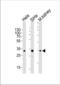 Snail Family Transcriptional Repressor 1 antibody, TA302097, Origene, Western Blot image 