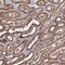 SPANX Family Member N4 antibody, NBP1-94095, Novus Biologicals, Immunohistochemistry paraffin image 