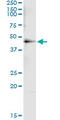 Histone Deacetylase 8 antibody, LS-C139403, Lifespan Biosciences, Immunoprecipitation image 