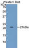 LIF Receptor Subunit Alpha antibody, LS-C302548, Lifespan Biosciences, Western Blot image 