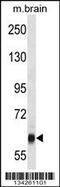 Vacuolar Protein Sorting 45 Homolog antibody, 58-263, ProSci, Western Blot image 