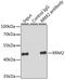 Ribonucleotide Reductase Regulatory Subunit M2 antibody, GTX33480, GeneTex, Immunoprecipitation image 