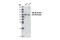 Ribosomal Protein S6 Kinase B1 antibody, 5707S, Cell Signaling Technology, Western Blot image 