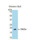 Slit homolog 3 protein antibody, LS-C299601, Lifespan Biosciences, Western Blot image 