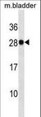 Galectin 3 antibody, LS-C158230, Lifespan Biosciences, Western Blot image 