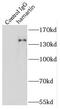 TSC Complex Subunit 1 antibody, FNab03751, FineTest, Immunoprecipitation image 