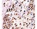 c-met antibody, F48414-0.4ML, NSJ Bioreagents, Western Blot image 