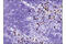 SIX Homeobox 1 antibody, 16960S, Cell Signaling Technology, Immunohistochemistry paraffin image 