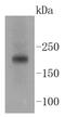 TSC Complex Subunit 2 antibody, NBP2-67552, Novus Biologicals, Western Blot image 