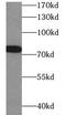 Vitronectin antibody, FNab09415, FineTest, Western Blot image 