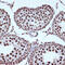 Interleukin Enhancer Binding Factor 3 antibody, GTX02844, GeneTex, Immunohistochemistry paraffin image 