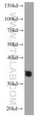 ADAM Metallopeptidase Domain 28 antibody, 22234-1-AP, Proteintech Group, Western Blot image 