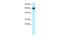 Ring Finger Protein, LIM Domain Interacting antibody, PA5-40489, Invitrogen Antibodies, Western Blot image 