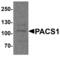 Phosphofurin Acidic Cluster Sorting Protein 1 antibody, MBS153625, MyBioSource, Western Blot image 